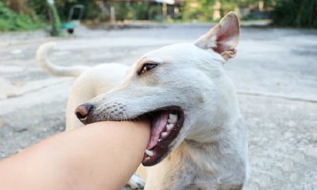 Approximately 4.7 million dog bites occur in the United States annually, says the CDC. (Photo: Shutterstock)