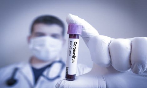 The coronavirus (COVID-19) outbreak is not currently anticipated to have a meaningful adverse impact on financial results reported by U.S. property/casualty (p/c) companies, nor their ratings, according to Fitch Ratings. (Photo: Shutterstock)