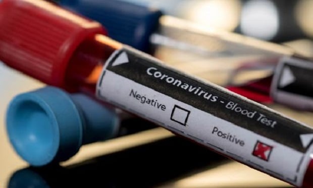 Laboratory research to find a vaccine for the coronavirus (COVID-19) disease. (Photo: VDjokich/Shutterstock)